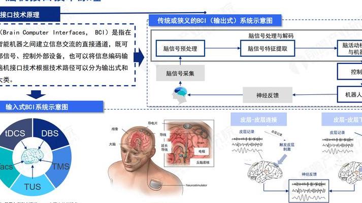 2025 年脑电波控制技术迈向市场应用，隐私安全引关注